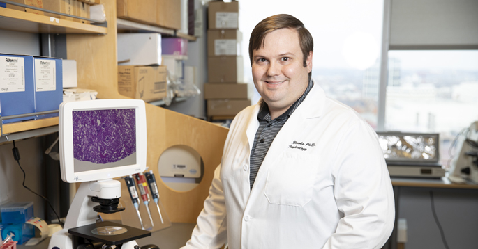 Craig Brooks, PhD, and colleagues are studying a molecular mechanism that promotes chronic kidney disease following kidney injury. (photo by Erin O. Smith)