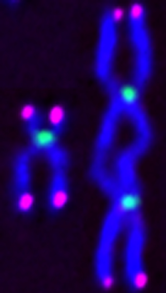 Images of mitotic chromosomes, stained for DNA (blue), centromeres (green), and telomeres, the protective chromosome “caps” (magenta). Normal chromosomes (at left) have one centromere and properly segregate in mitosis, but loss of SETD2 activity results in the formation of chromosomes with two centromeres (at right), called dicentric chromosomes, which in many cases are mirror-imaged isochromosomes.