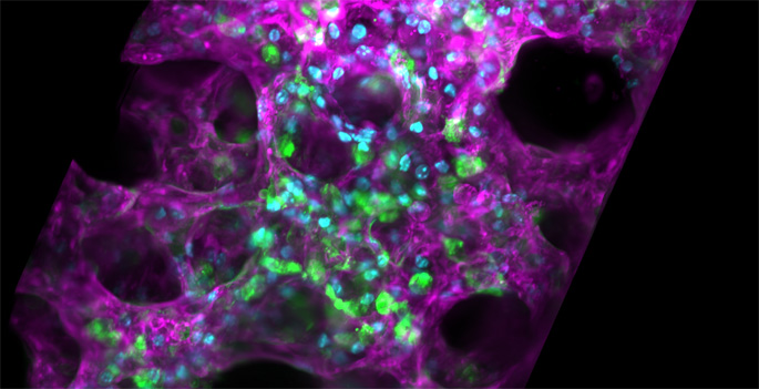 In this 3D projected still image from a precision cut lung slice, alveolar epithelial cells are labeled green. All other cells are seen in purple.