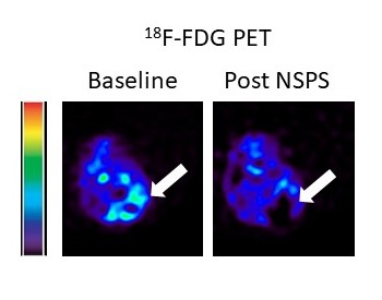 From left, images of a mouse model of breast cancer before and after NSPS administration.