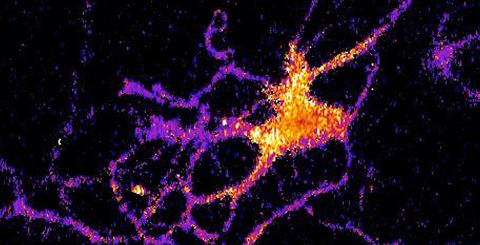 glowing brain cell