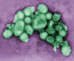 A microscopic view of H1N1