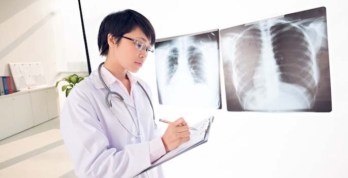doctor or nurse examining chest x-ray