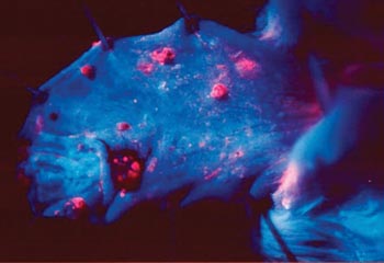 Epithelial cancer cells glow in this hamster cheek pouch after topical application of a special fluorescent molecule that "tags" cancer cells so they can be seen during surgery.