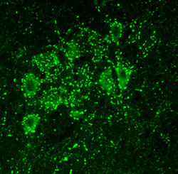Randy Blakely, Ph.D. and colleagues demonstrated that the choline transporter protein is present inside nerve cell terminals, pictured here as bright green dots. The terminals in this preparation are making contact with brainstem neurons. Image courtesy of Randy Blakely, Ph.D.