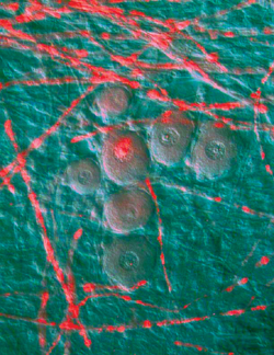Crisscrossing myelinated axons are red in this picture of nerve cells growing in the laboratory. Vanderbilt scientists are using the nerve cell cultures to study the formation of myelin. (Image courtesy of Bruce Carter and Josh Nickols)