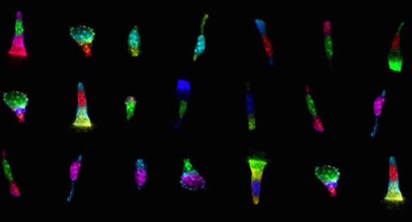 Single-cell immunofluorescence in samples from colon biopsies. (Alan J. Simmons, Vanderbilt University)