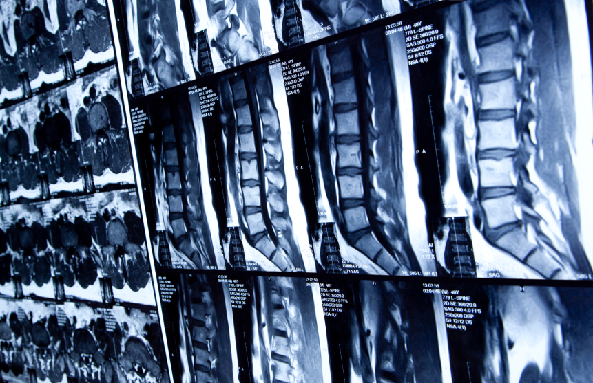 spine x-rays
